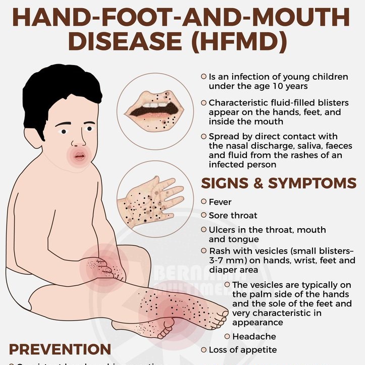 Hand-Foot-Mouth Disease