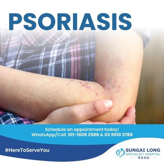 Psoriasis